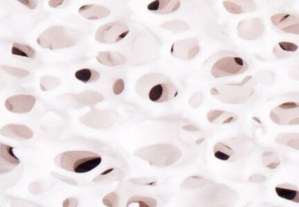 porous ceramic filters
