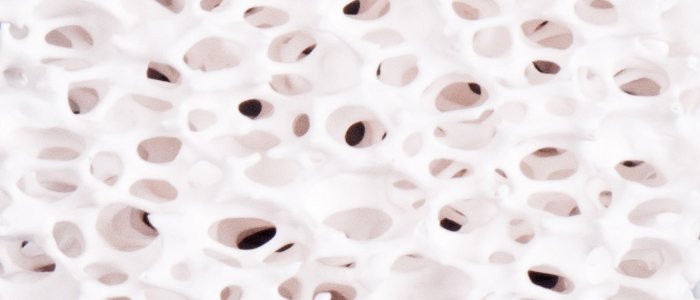 porous ceramic foam filters